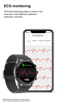 Xiaomi Smartwatch Brezžično Polnjenje Bluetooth Klic 454*454 HD Full Screen Smart Watch EKG PPG Rotacijski Gumb Smartwatch Za Moške